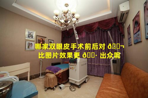 哪家双眼皮手术前后对 🐬 比图片效果更 🌷 出众呢